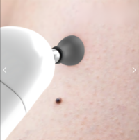 Penguin Wi-Fi Otoscope + Dermatoscope for Humans